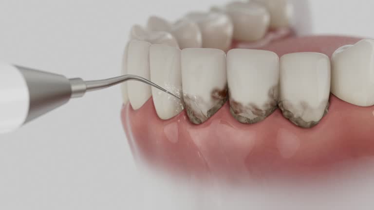 Reliable Dental Implants contractor in Oblong, IL by Smile Center Dentistry